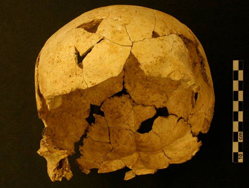 Crani d'humà modern (Homo sapiens) més antiga de Catalunya, trobat a Serinyà. Té una antiguitat duns 22.000 anys